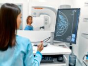 El 84% de pacients amb càncer de mama HR+/HER2- tem una recaiguda