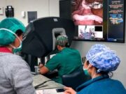 Operar amb precisió mil·limètrica: el GPS que guia els cirurgians